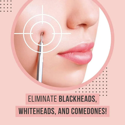 Stainless Steel Blackhead Remover Tools Set with Pimple Extractors 4 Pieces - Rose Gold