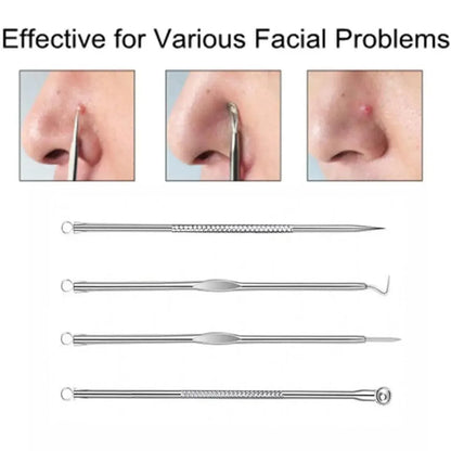 Stainless Steel Blackhead Remover Tools Set with Pimple Extractors 4 Pieces - Gold