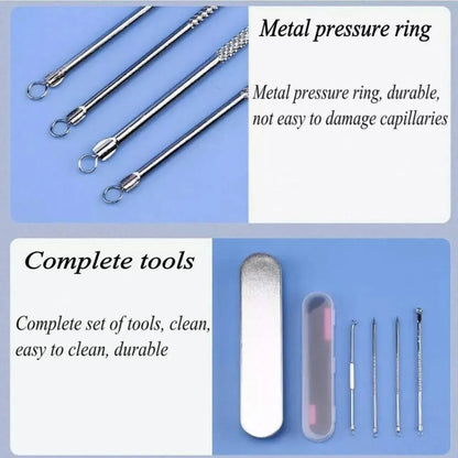 Stainless Steel Blackhead Remover Tools Set with Pimple Extractors 4 Pieces - Gold