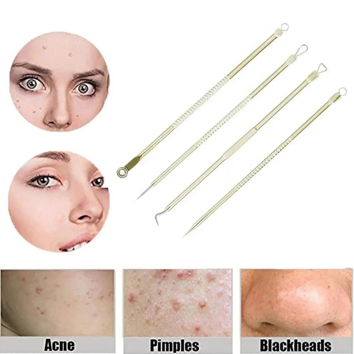 Stainless Steel Blackhead Remover Tools Set with Pimple Extractors 4 Pieces - Gold