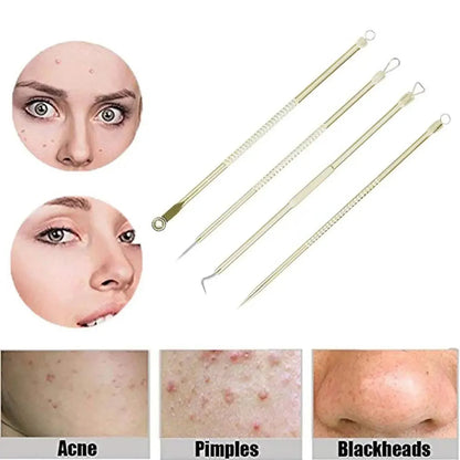 Stainless Steel Blackhead Remover Tools Set with Pimple Extractors 4 Pieces - Gold